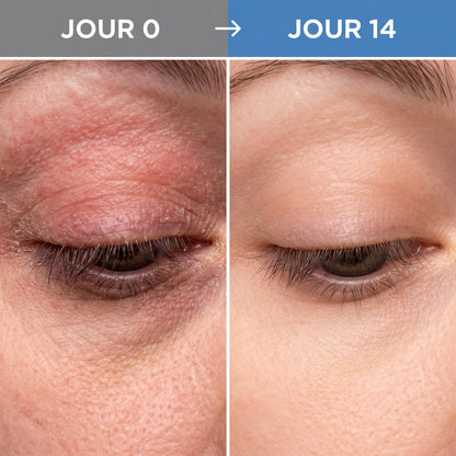 Veria™ Masque Thermique - Veria